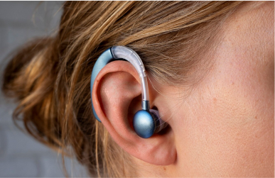 audiometría